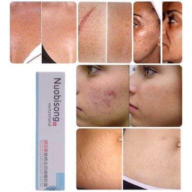 fast acne scar removal cream
