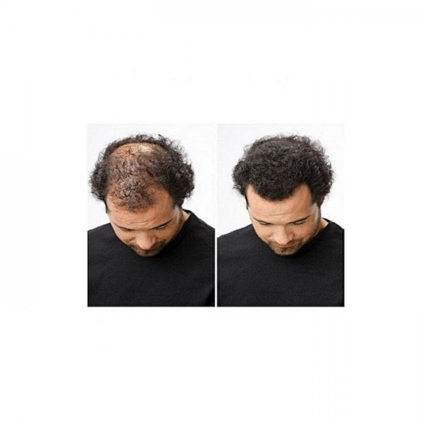 Buy Caboki Hair Building Fiber Black and Dark brown online in Pakistan | Buy Caboki Hair Building Fiber Black and Dark brown online in Pakistan |