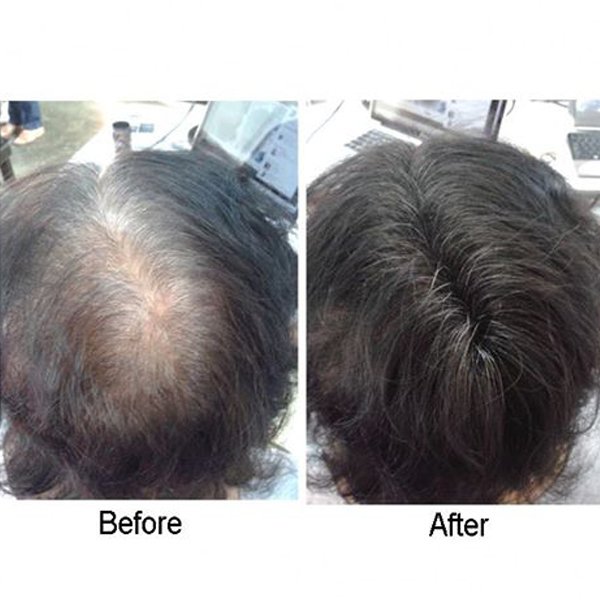 Caboki Hair Loss Concealer Building Fiber - 25g Caboki Hair Loss Concealer Building Fiber - 25g