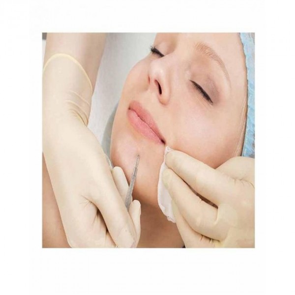 Pimple and Blemish Remover 2In1 Extractor Tool Buyon.pk